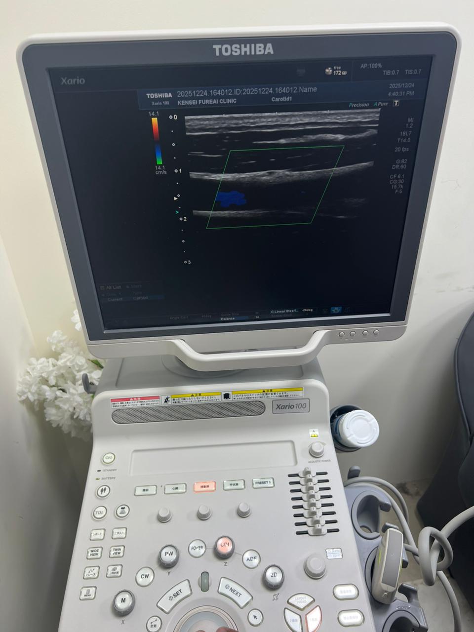 Toshiba Xario 100 ultrasound with cardiac,linear and convex probe refurbished equipment