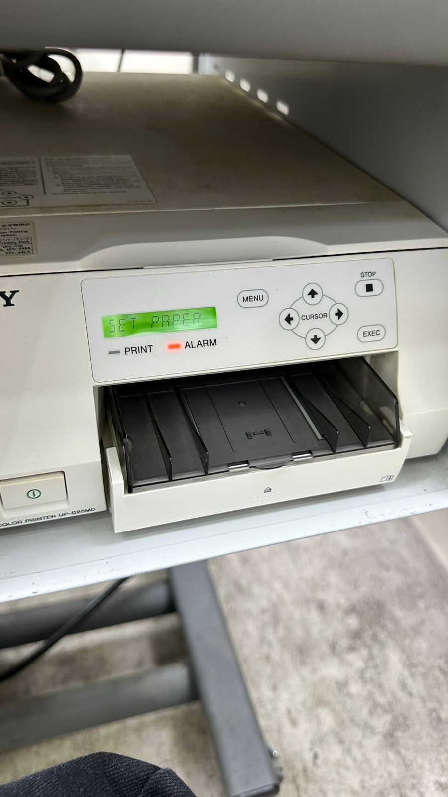 kowa nonmyd 7 fundus camera 12 mega