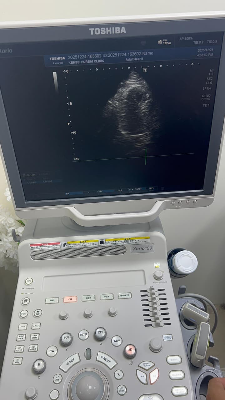 Toshiba Xario 100 ultrasound with cardiac,linear and convex probe refurbished equipment