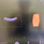 GE VOLUSON E10 Ultrasound