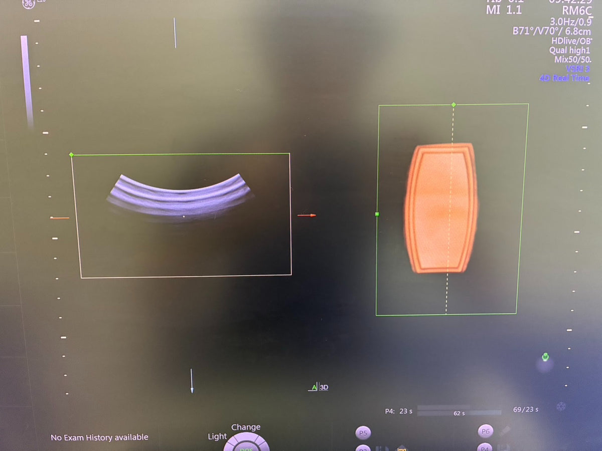 GE VOLUSON E10 Ultrasound