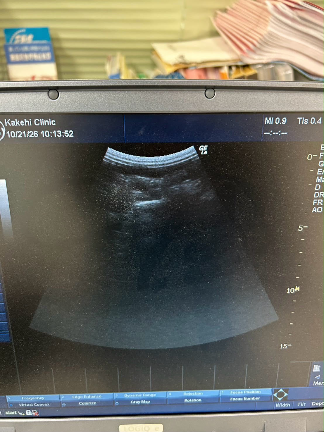 GE LOGIQ e Rev 2 Portable ultrasound