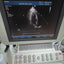 Hd11xe ultrasound With adult cardiac pediatric cardiac  and linear probes