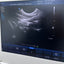 Philips CX50 portable ultrasound with convex and TVS probe