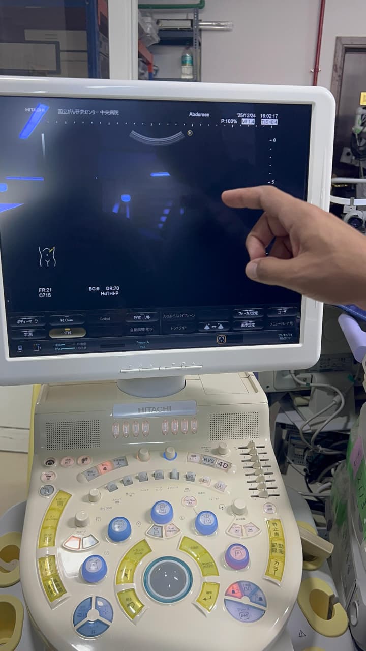 Hitachi Hi Vision preirus ultrasound convex and linear probe
