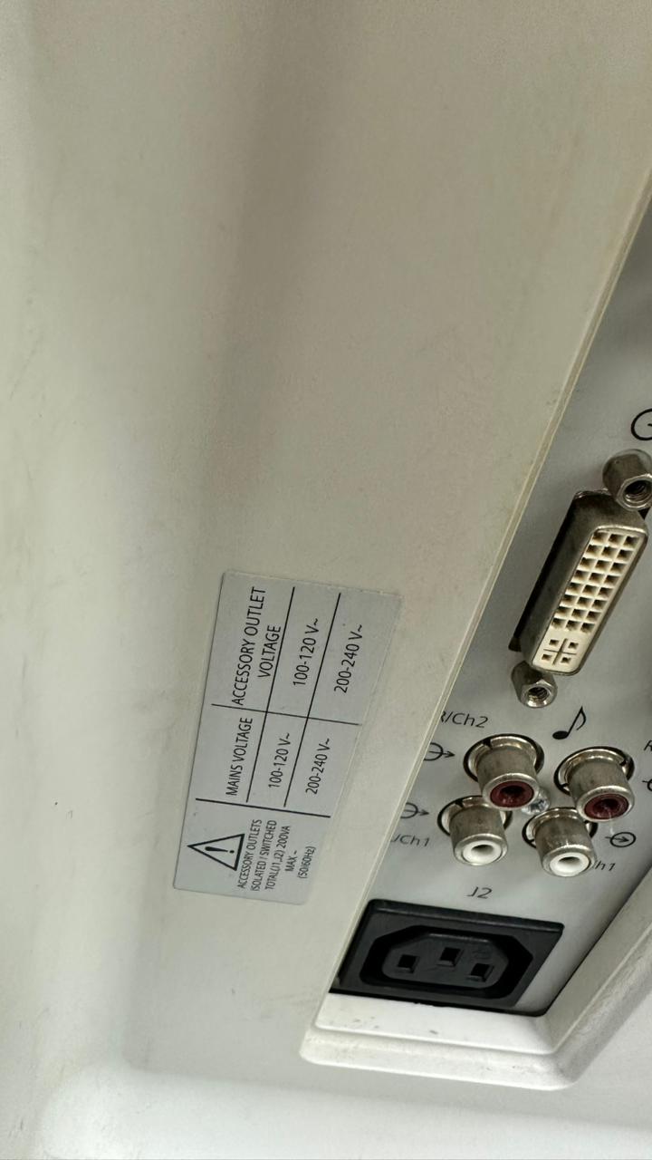 SIEMENS ACUSON X700 ULTRASOUND WITH LINEAR AND CONVEX PROBE