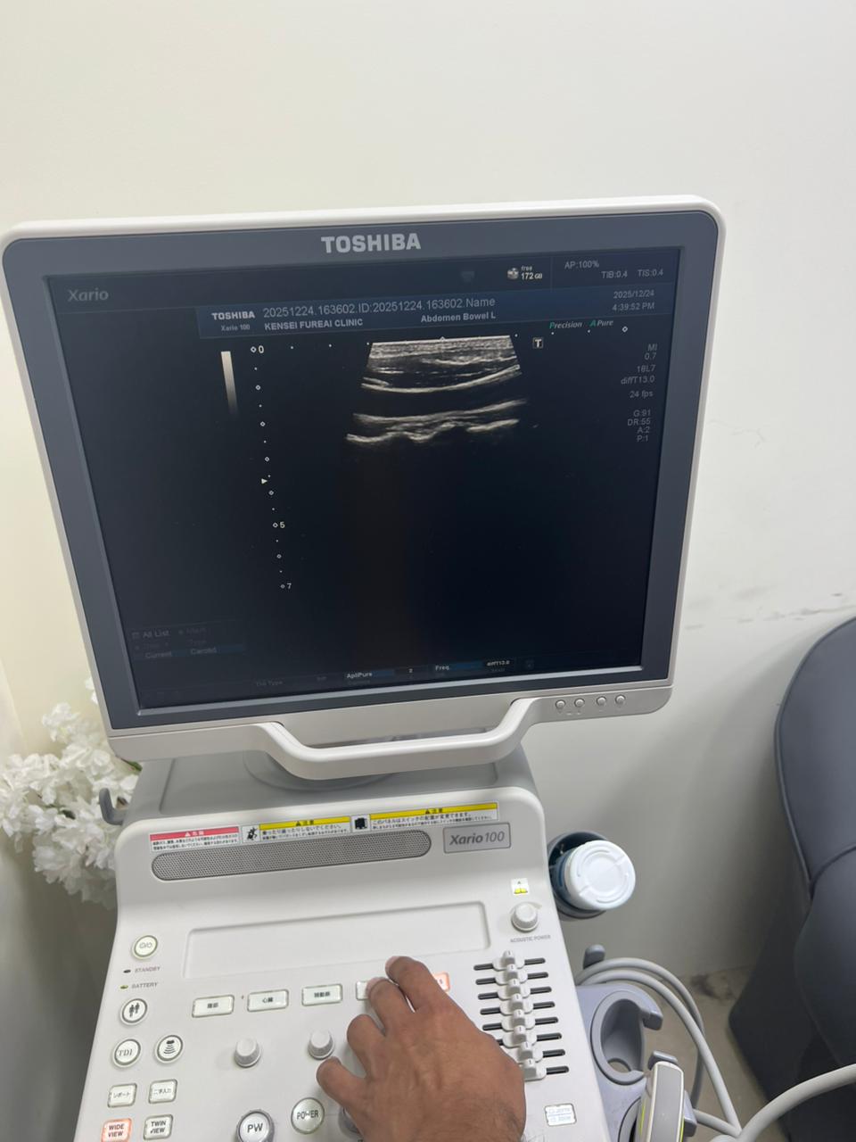 Toshiba Xario 100 ultrasound with cardiac,linear and convex probe refurbished equipment