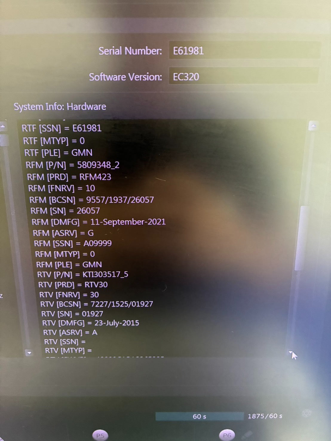 GE VOLUSON E10 Ultrasound