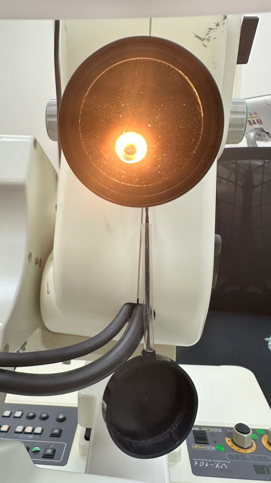 Kowa VX-10i fundus camera