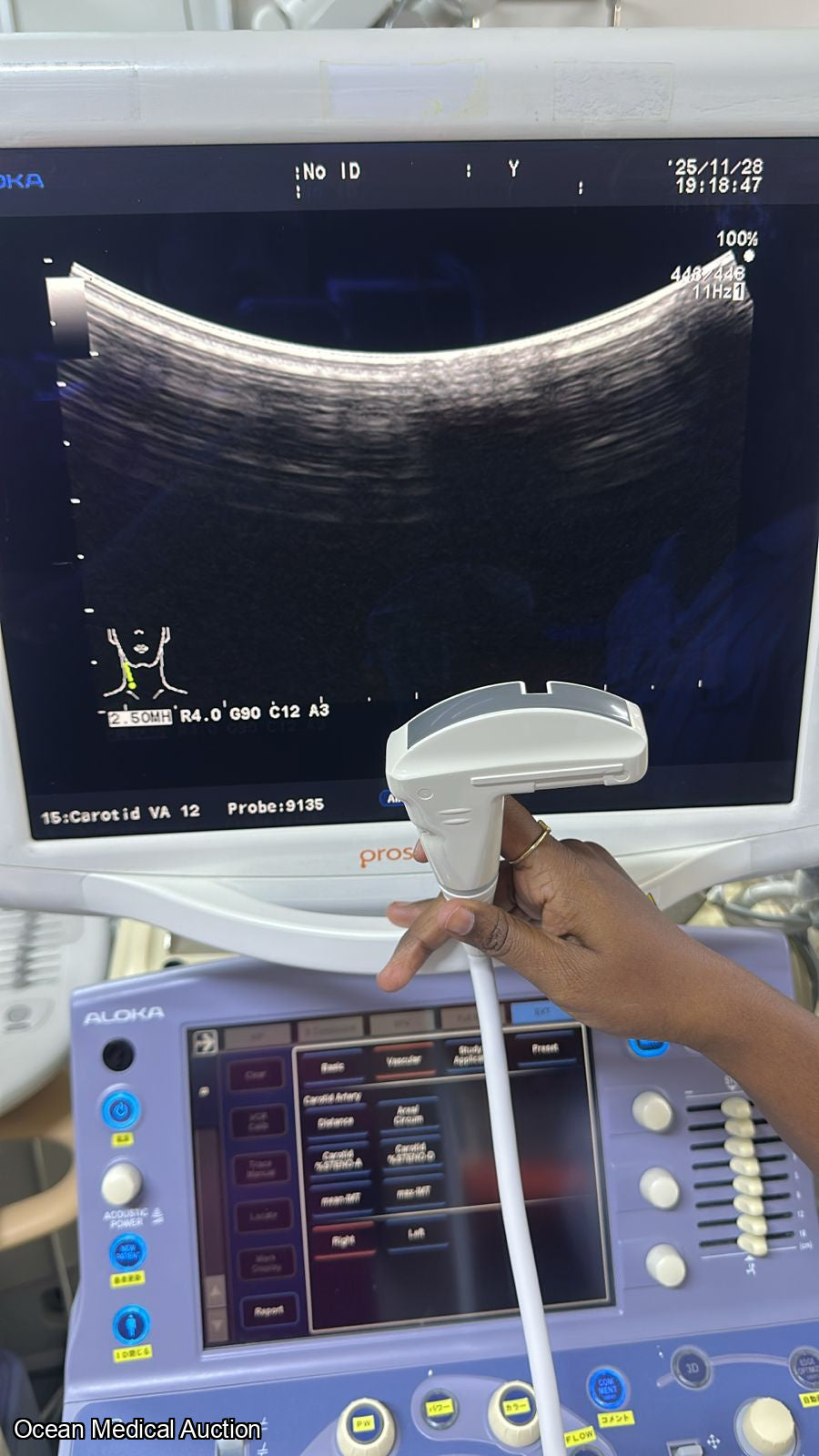 Aloka Ust 9135p curved (convex) array ultrasound transducer / probe.SN.20050045