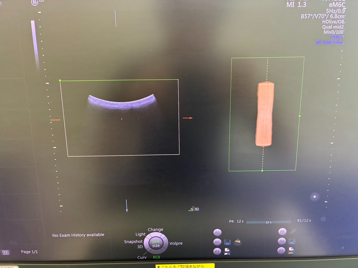 GE VOLUSON E10 Ultrasound