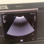 Philips EPIQ 7G ultrasound Refurbished equipment