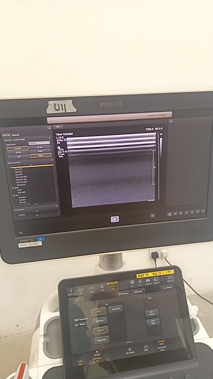 Philips EPIQ 7G ultrasound Refurbished equipment