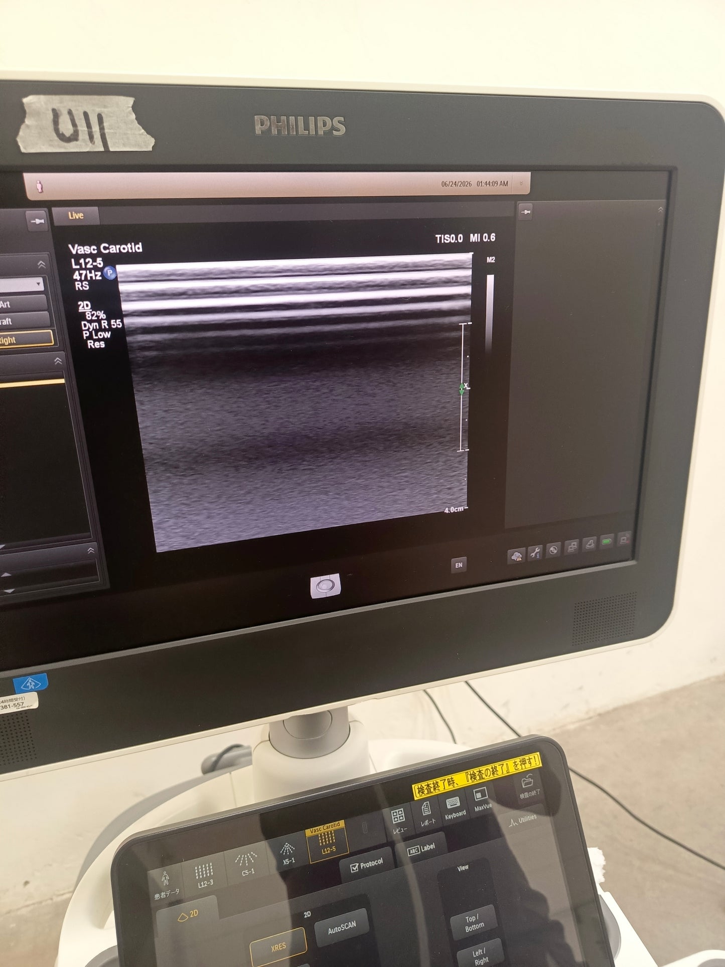 Philips EPIQ 7G ultrasound Refurbished equipment