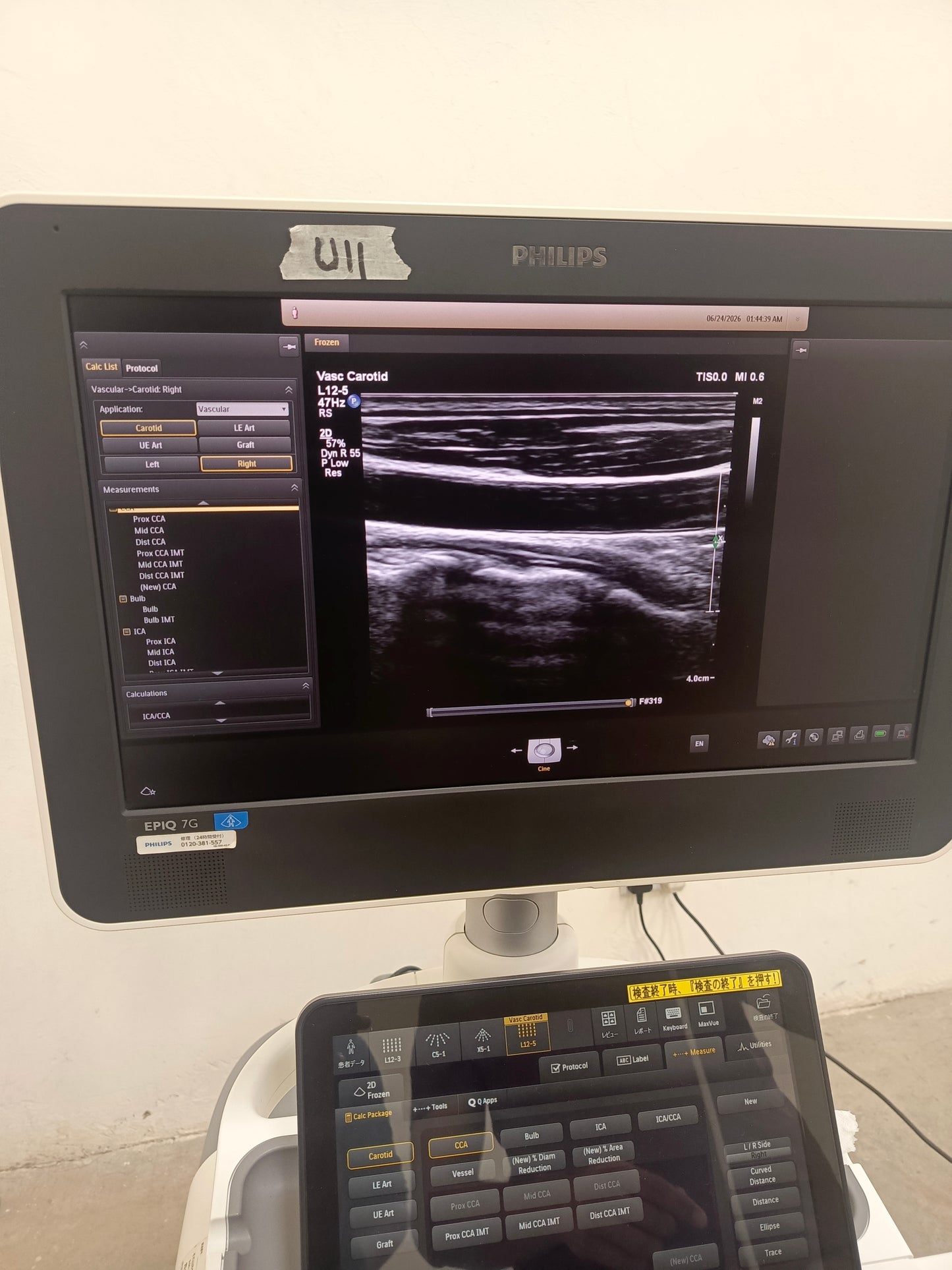 Philips L12-5 50 wide array ultrasound Transducer / Probe Affiniti Epiq CX50 ultrasound BH.