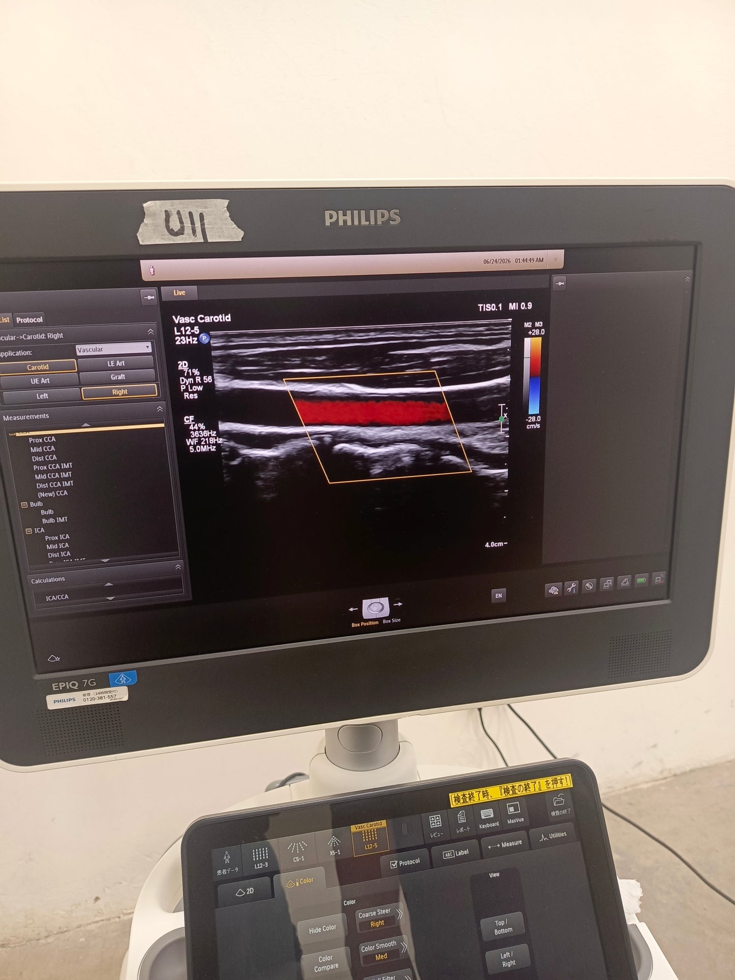 Philips L12-5 50 wide array ultrasound Transducer / Probe Affiniti Epiq CX50 ultrasound BH.