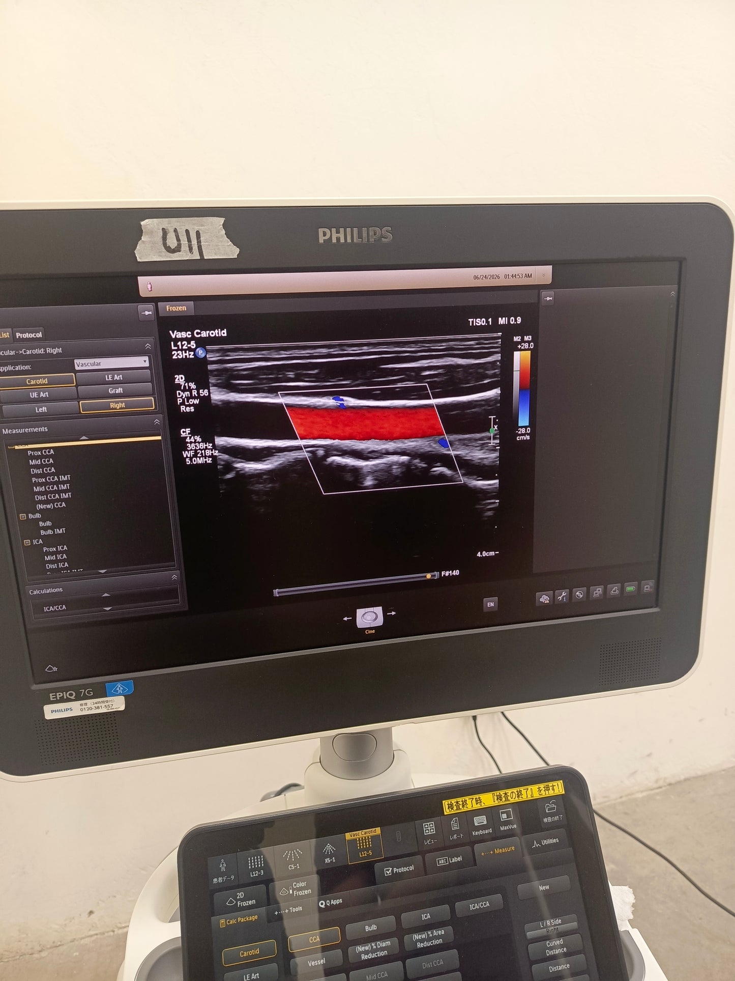 Philips L12-5 50 wide array ultrasound Transducer / Probe Affiniti Epiq CX50 ultrasound BH.