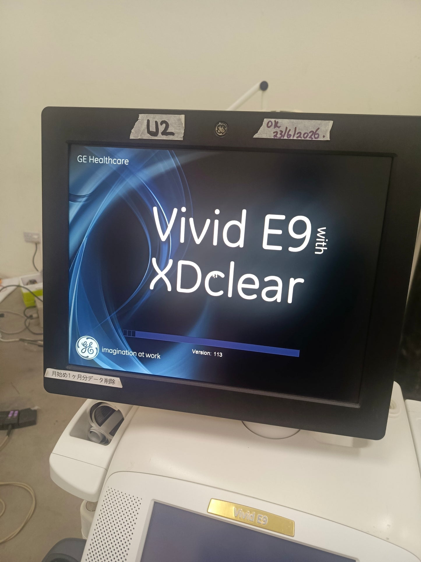 GE ultrasound vivid E9 with a convex probe