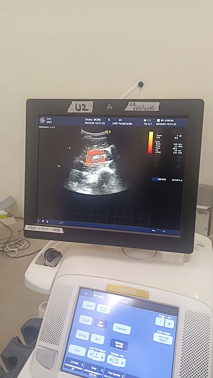 GE ultrasound vivid E9 with a convex probe