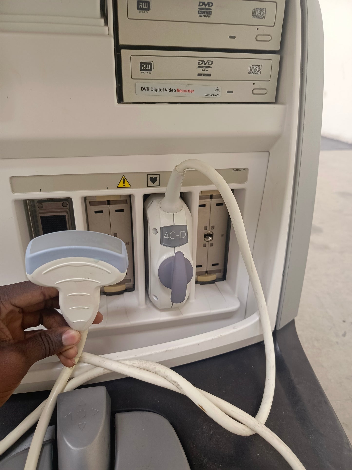 GE ultrasound vivid E9 with a convex probe