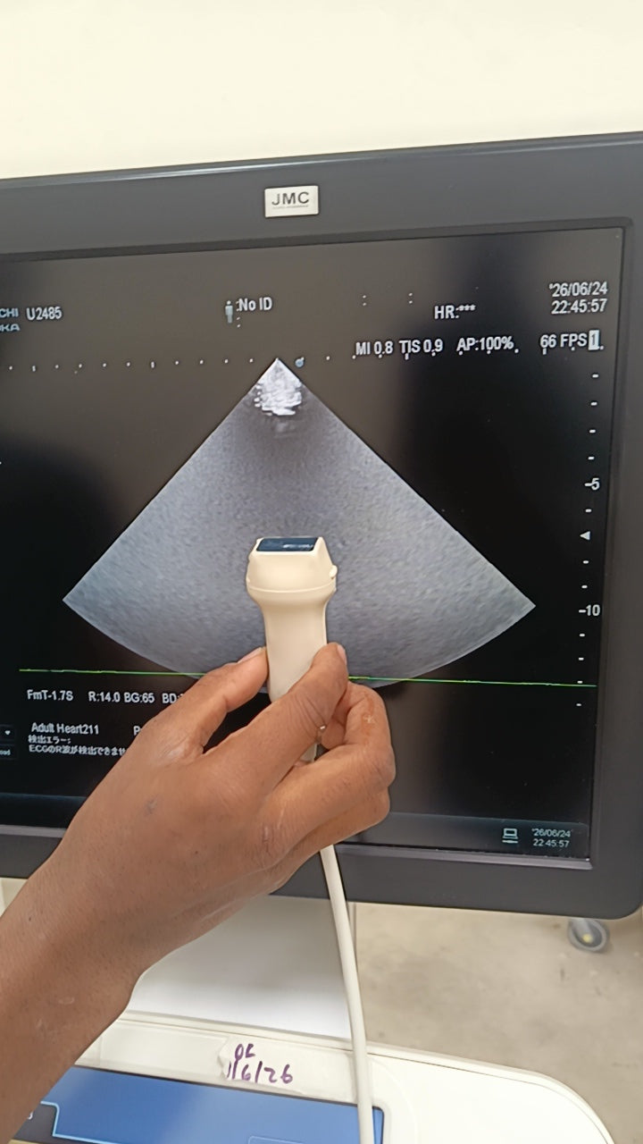 Hitachi aloka arieta 60 with convex probe, linear array prone and cardiac array probe BH