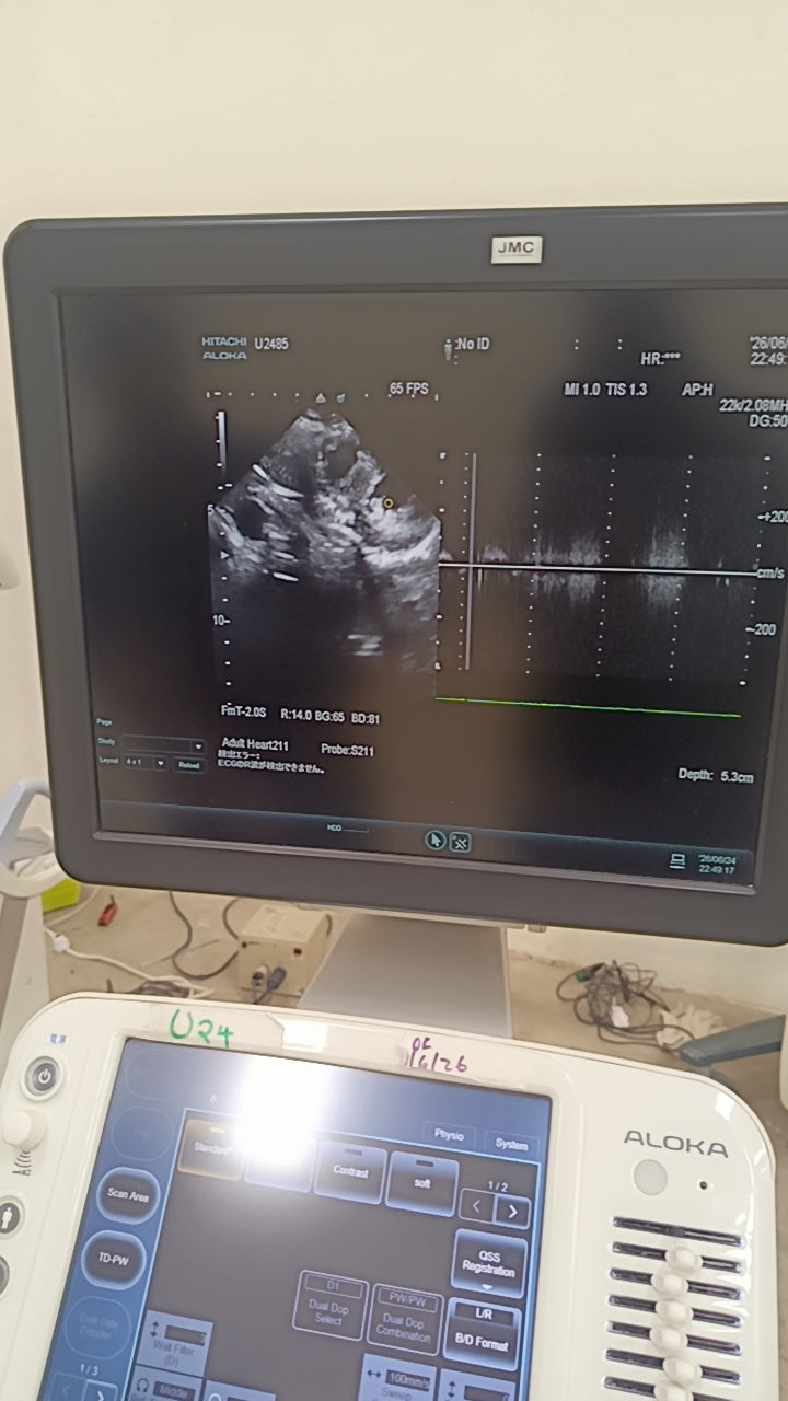 Hitachi aloka arieta 60 with convex probe, linear array prone and cardiac array probe BH