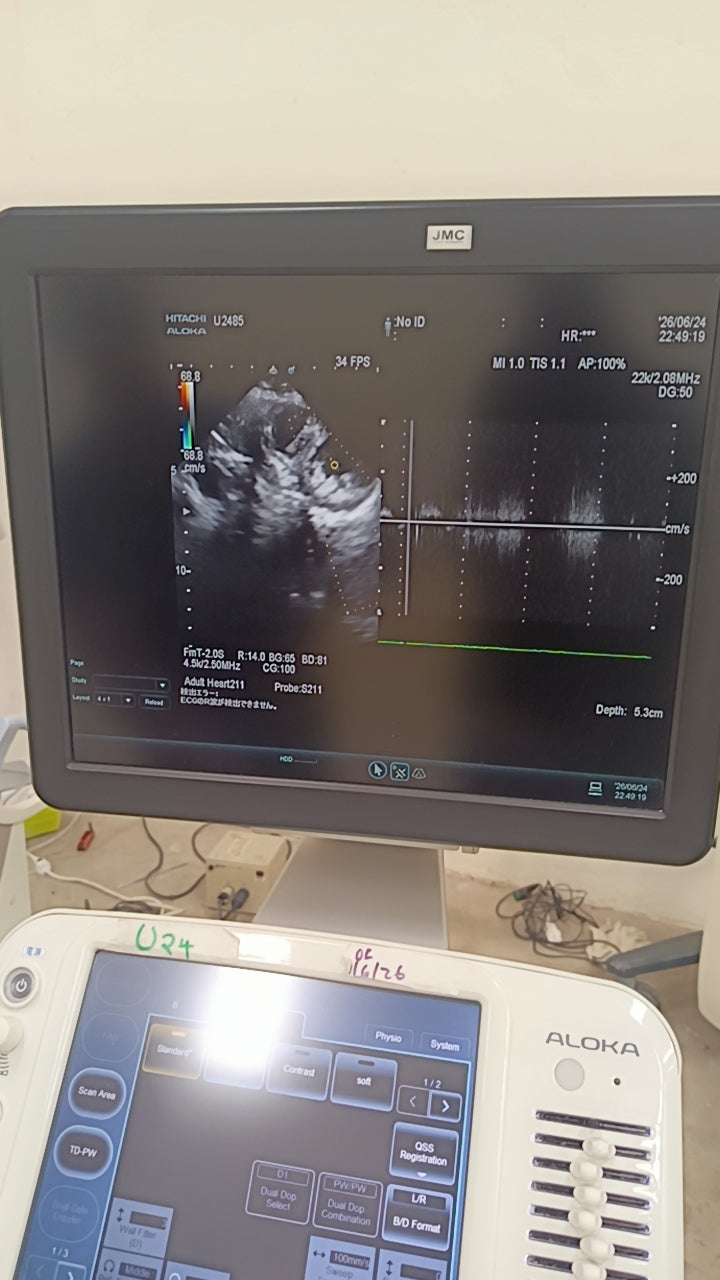 Hitachi aloka arieta 60 with convex probe, linear array prone and cardiac array probe BH