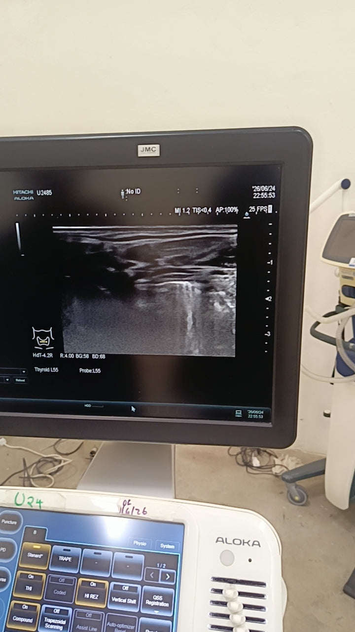 Hitachi aloka arieta 60 with convex probe, linear array prone and cardiac array probe BH