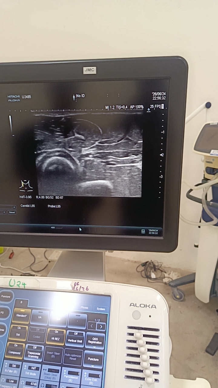 Hitachi aloka arieta 60 with convex probe, linear array prone and cardiac array probe BH