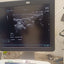 Hitachi aloka arieta 60 with convex probe, linear array prone and cardiac array probe BH