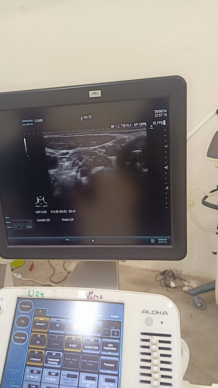 Hitachi aloka arieta 60 with convex probe, linear array prone and cardiac array probe BH