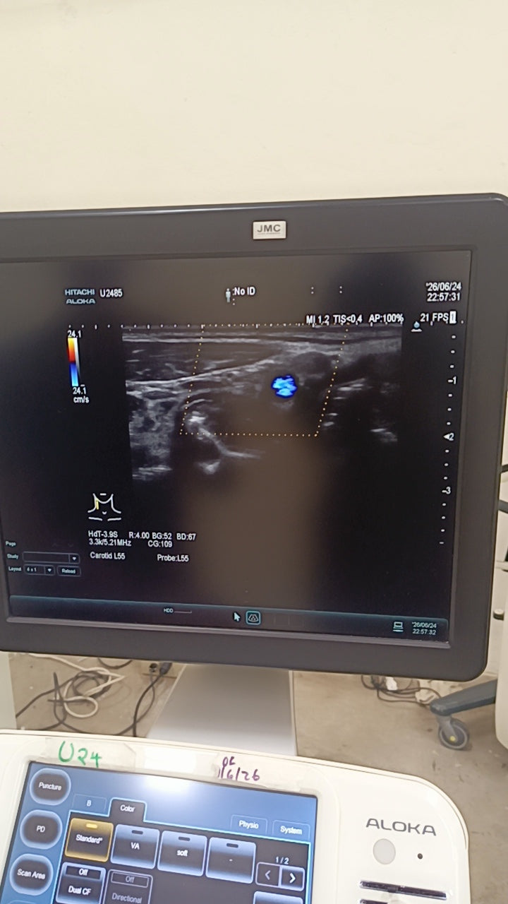 Hitachi aloka arieta 60 with convex probe, linear array prone and cardiac array probe BH