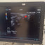 Hitachi aloka arieta 60 with convex probe, linear array prone and cardiac array probe BH
