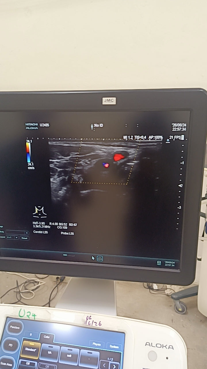 Hitachi aloka arieta 60 with convex probe, linear array prone and cardiac array probe BH