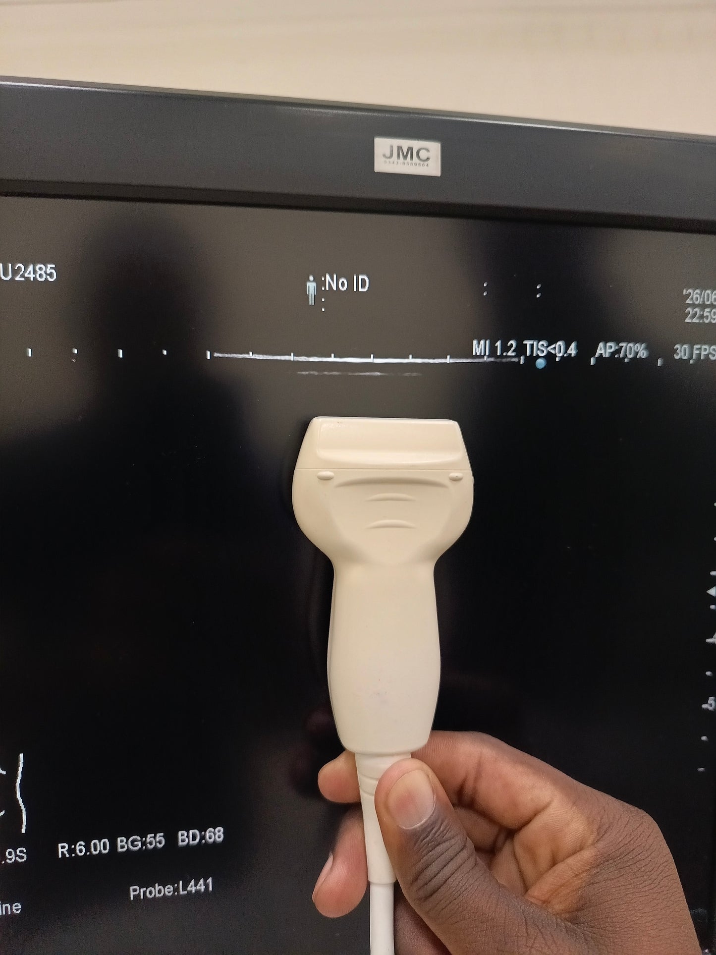 Hitachi aloka arieta 60 with convex probe, linear array prone and cardiac array probe BH
