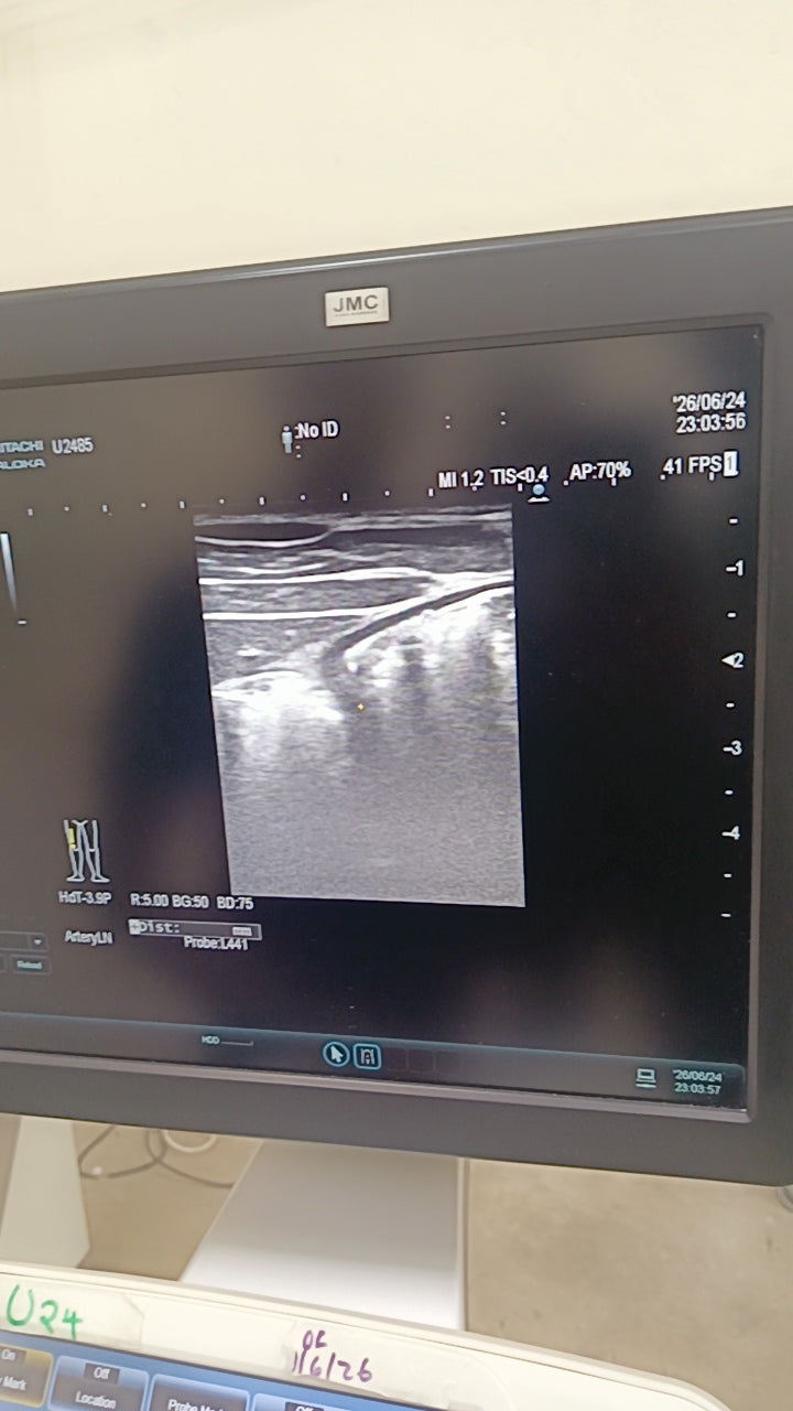 HITACHI aloka L441 Linear Array ultrasound Transducer / Probe for Hitachi arieta 60/70 ultrasounds BH