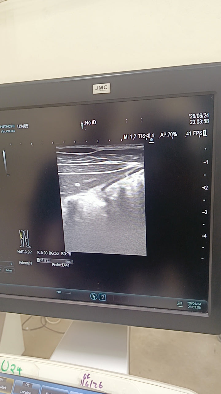 Hitachi aloka arieta 60 with convex probe, linear array prone and cardiac array probe BH