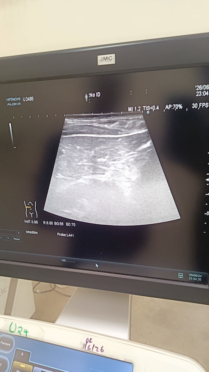 Hitachi aloka arieta 60 with convex probe, linear array prone and cardiac array probe BH