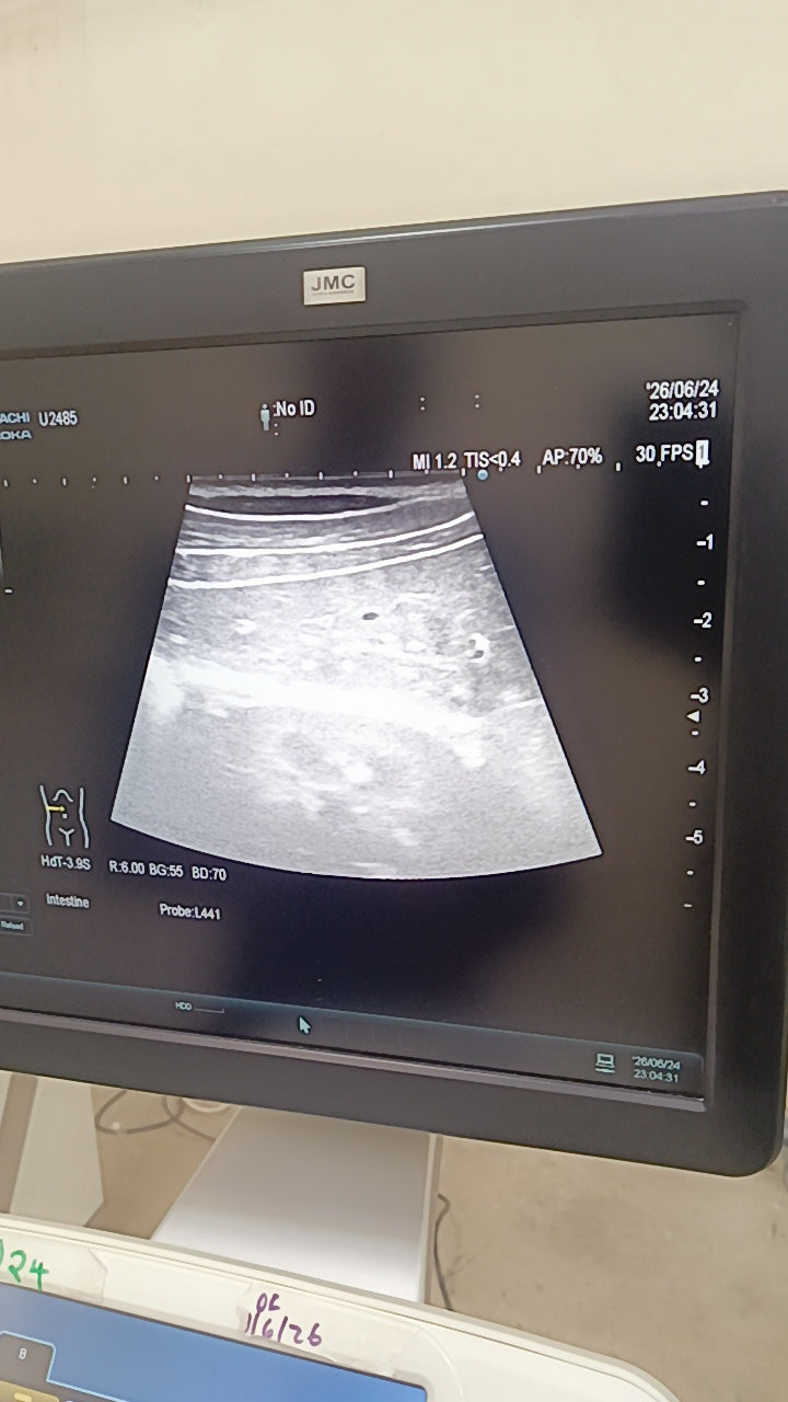 Hitachi aloka arieta 60 with convex probe, linear array prone and cardiac array probe BH