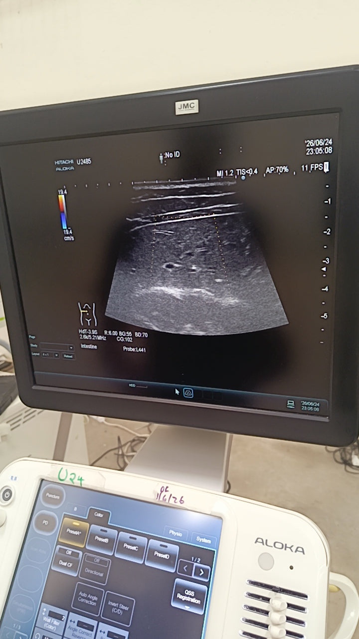 HITACHI aloka L441 Linear Array ultrasound Transducer / Probe for Hitachi arieta 60/70 ultrasounds BH