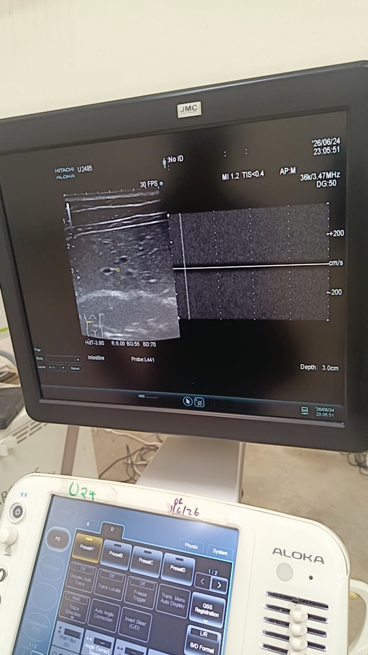 Hitachi aloka arieta 60 with convex probe, linear array prone and cardiac array probe BH