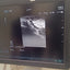 Hitachi aloka arieta 60 with convex probe, linear array prone and cardiac array probe BH