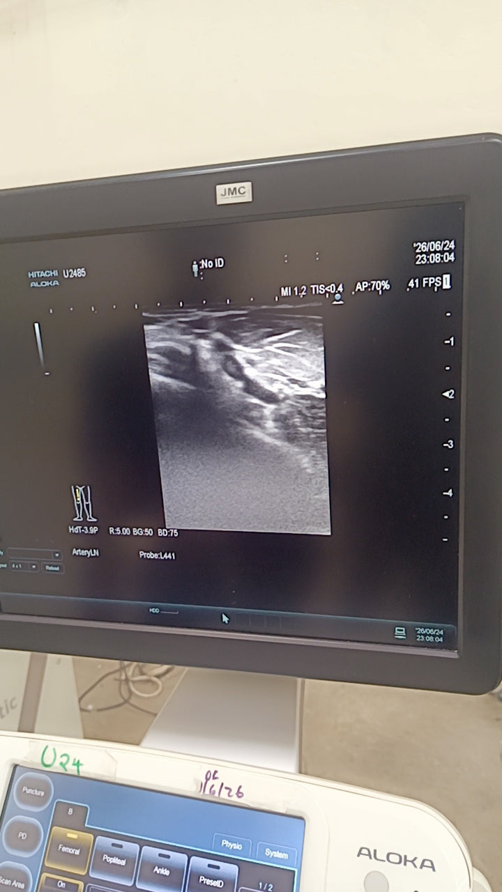 Hitachi aloka arieta 60 with convex probe, linear array prone and cardiac array probe BH