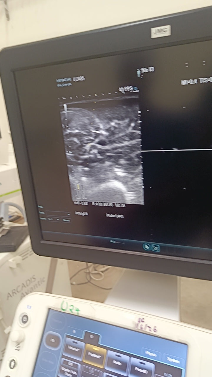 Hitachi aloka arieta 60 with convex probe, linear array prone and cardiac array probe BH
