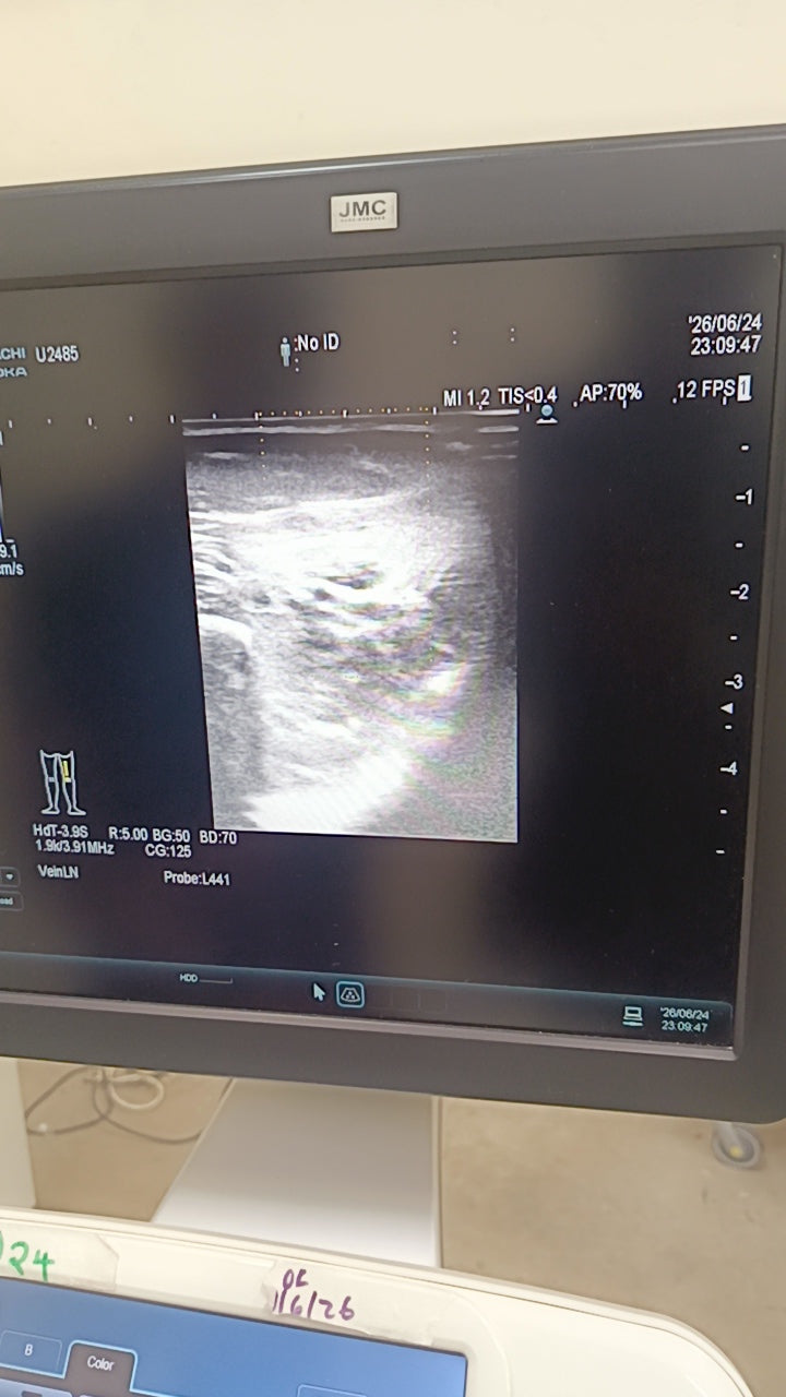 Hitachi aloka arieta 60 with convex probe, linear array prone and cardiac array probe BH