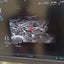 Hitachi aloka arieta 60 with convex probe, linear array prone and cardiac array probe BH