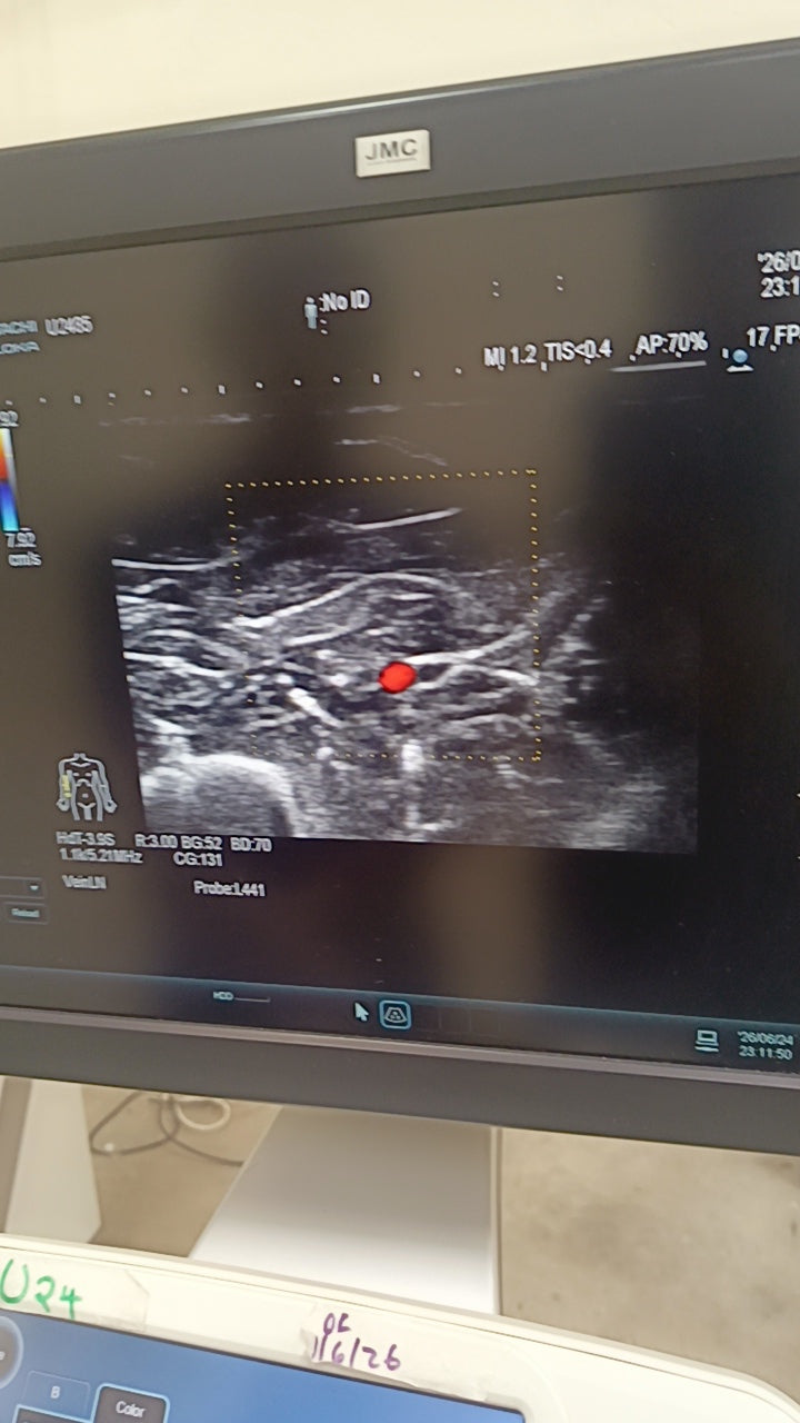 Hitachi aloka arieta 60 with convex probe, linear array prone and cardiac array probe BH
