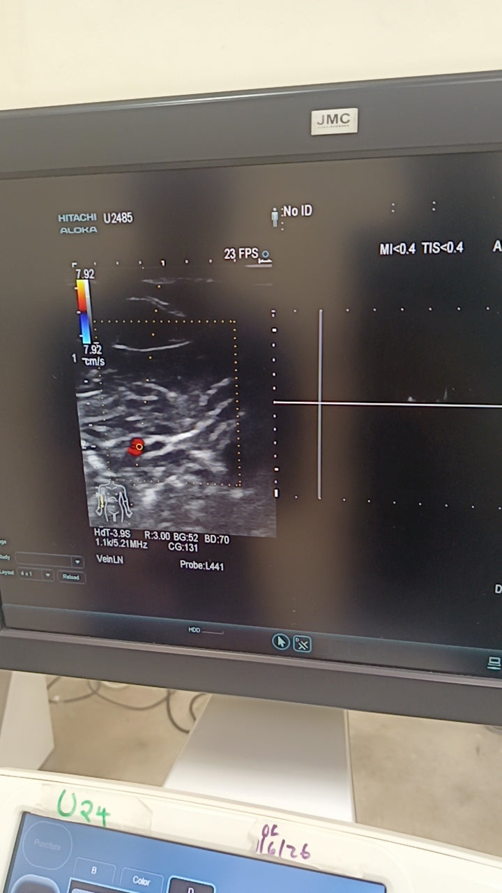 Hitachi aloka arieta 60 with convex probe, linear array prone and cardiac array probe BH