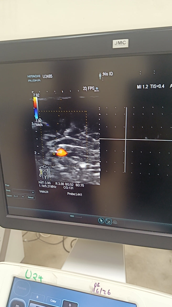HITACHI aloka L441 Linear Array ultrasound Transducer / Probe for Hitachi arieta 60/70 ultrasounds BH