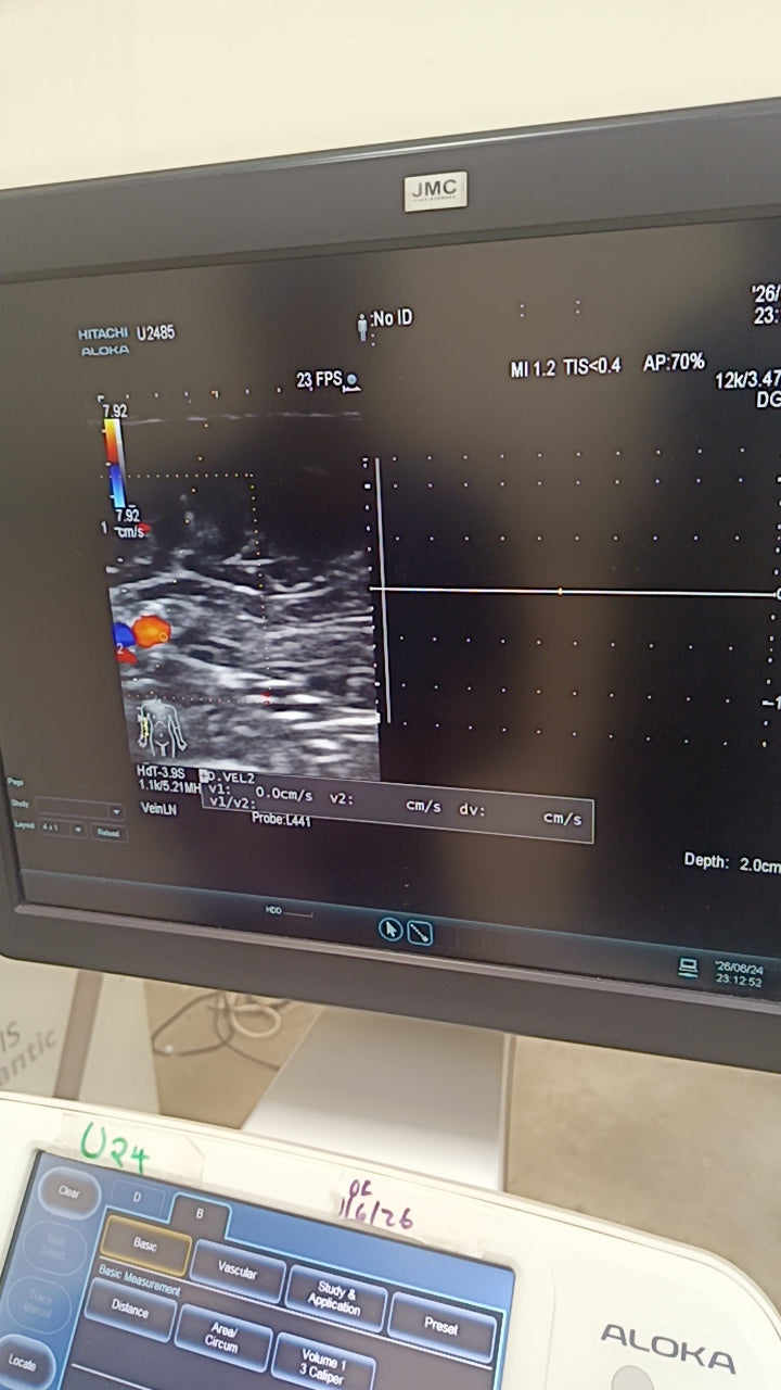 Hitachi aloka arieta 60 with convex probe, linear array prone and cardiac array probe BH